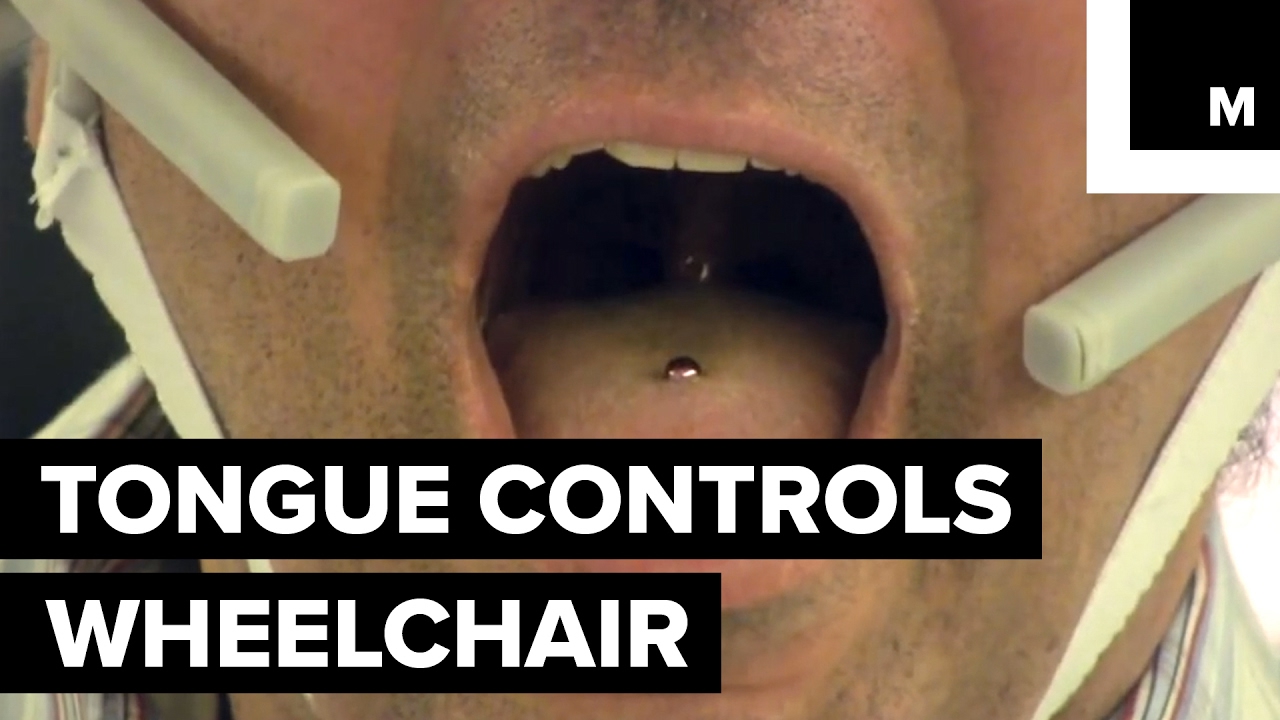 Tongue-controlled wheelchair
