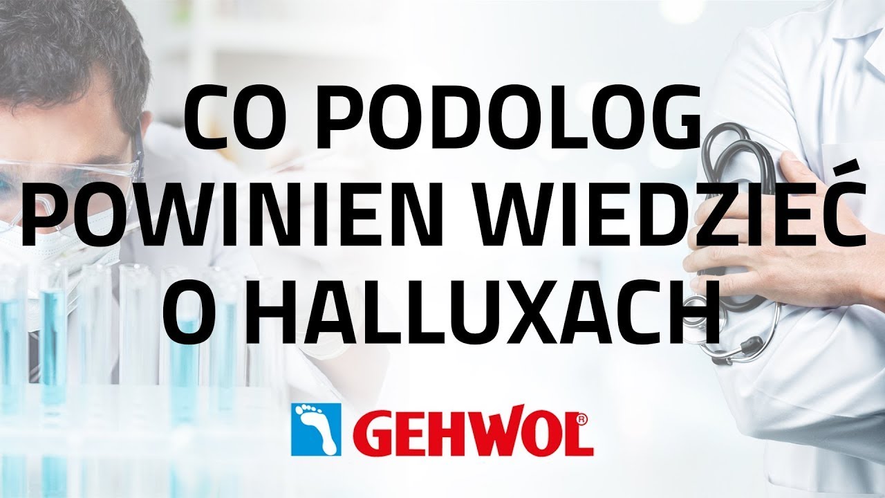 CO PODOLOG POWINIEN WIEDZIEĆ O HALLUXACH
