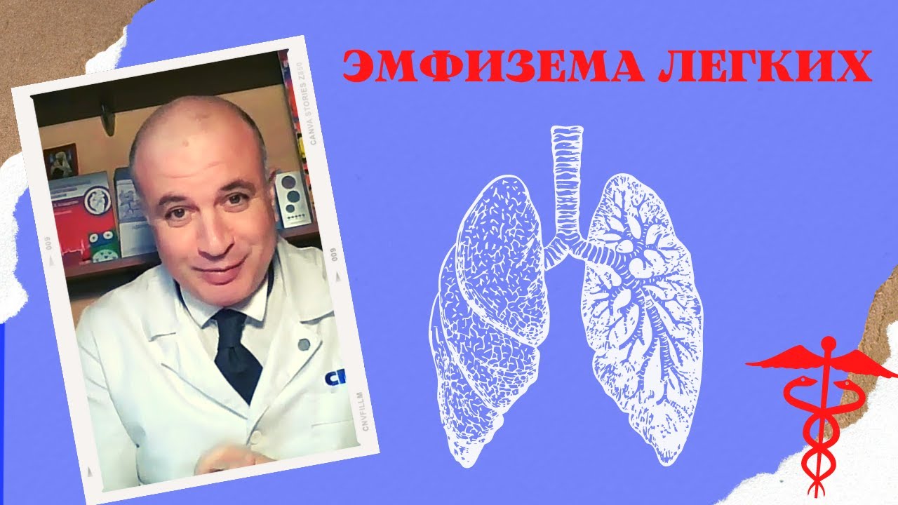 ЭМФИЗЕМА легких. Почему гибнут альвеолы?