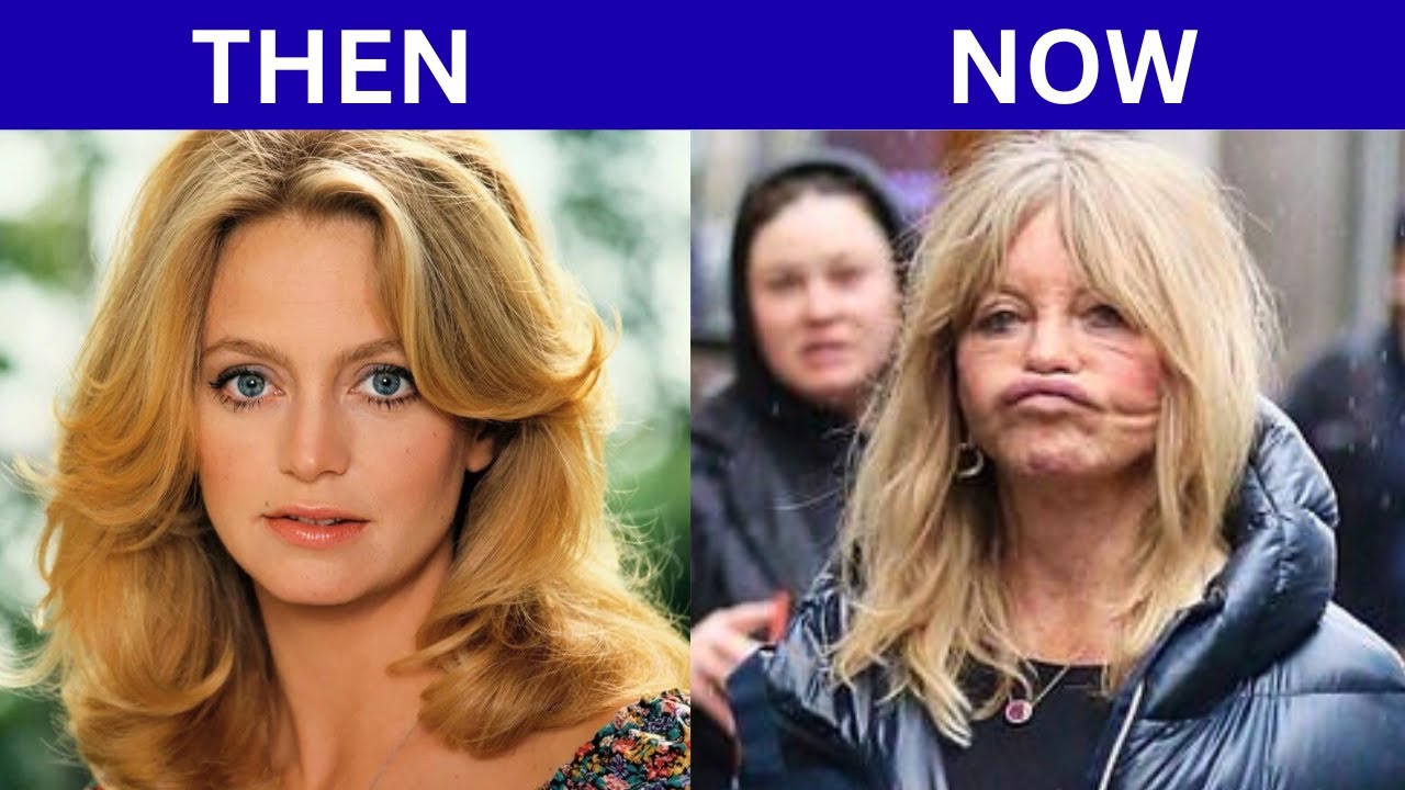 50+ Celebrities Who Aged Badly | Then and Now