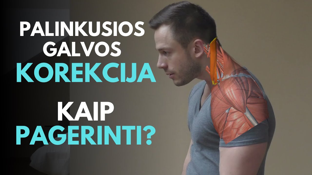 Palinkusi galva į priekį? Korekcija: ką ir kaip daryti, kad pataisytumėte.