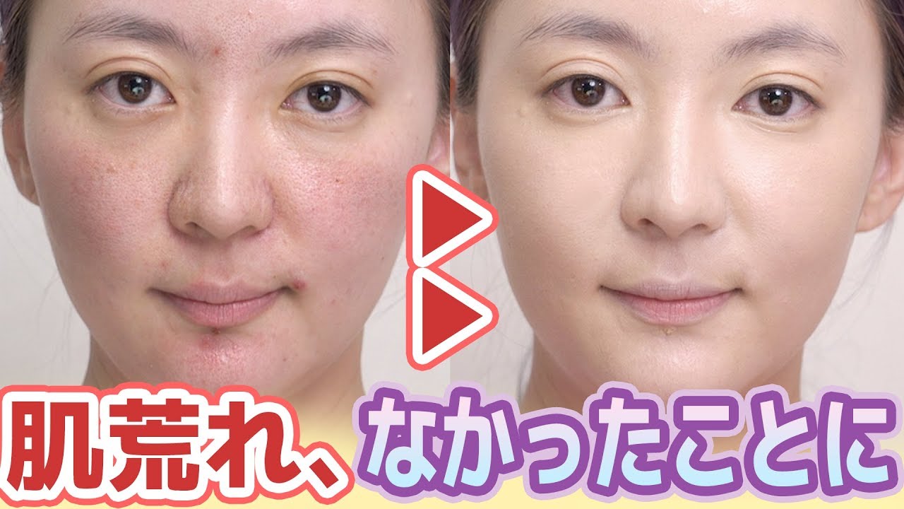 荒れた肌、ベースメイクで何とかできる！