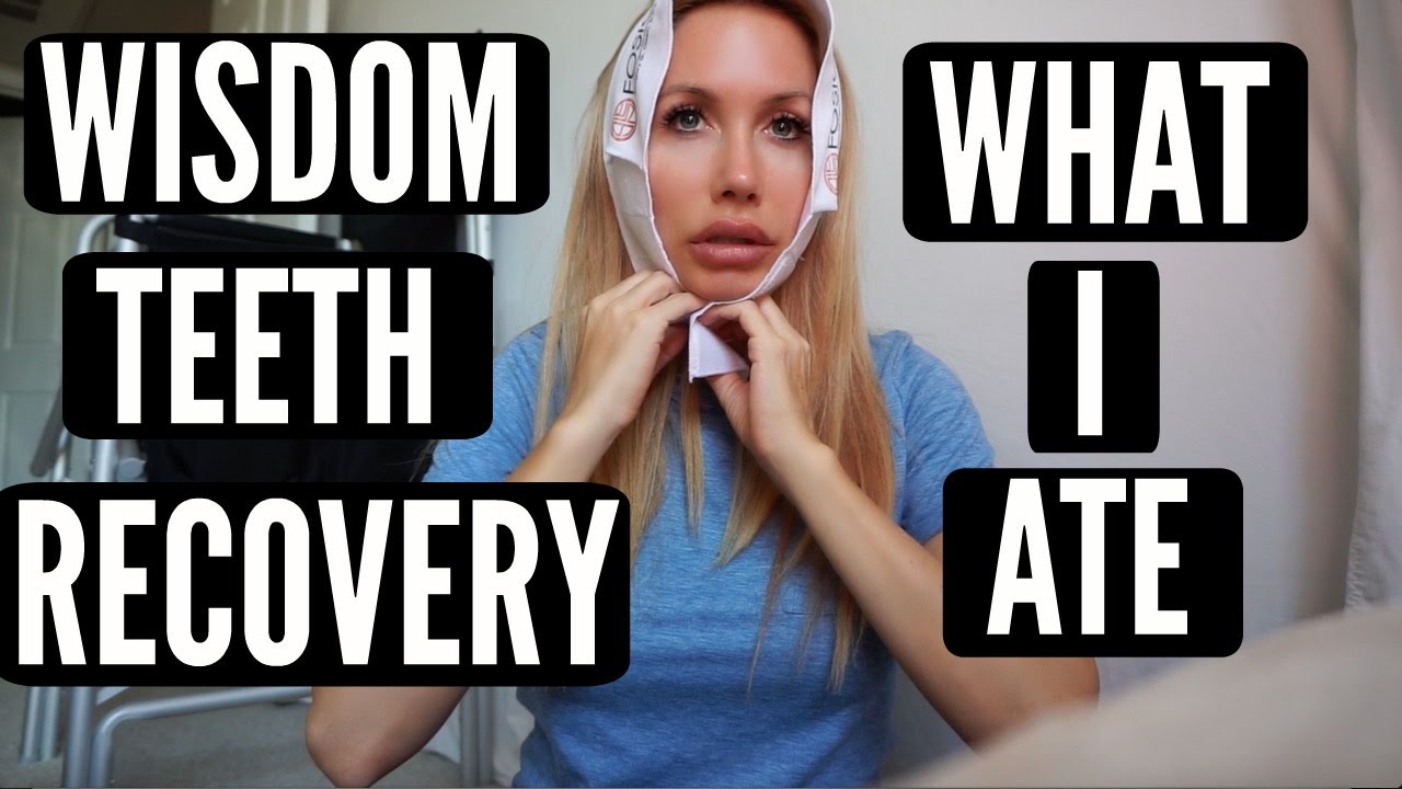WISDOM TEETH RECOVERY + WHAT I ATE