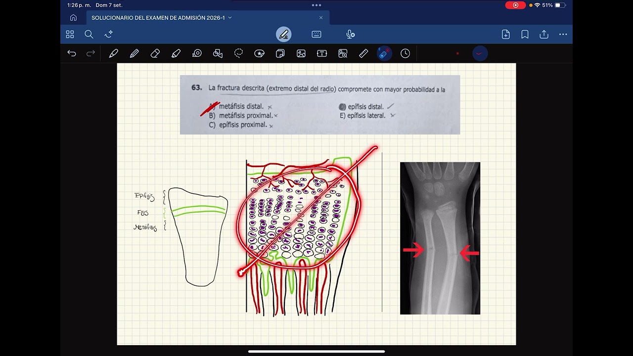 RESOLUCIÓN DEL EXAMEN DE ADMISIÓN UNHEVAL 2026-1 (curso de Anatomía)