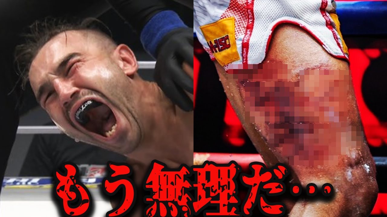 【衝撃】戦慄のキックKO！痛すぎて地獄・・・【格闘技/k1】