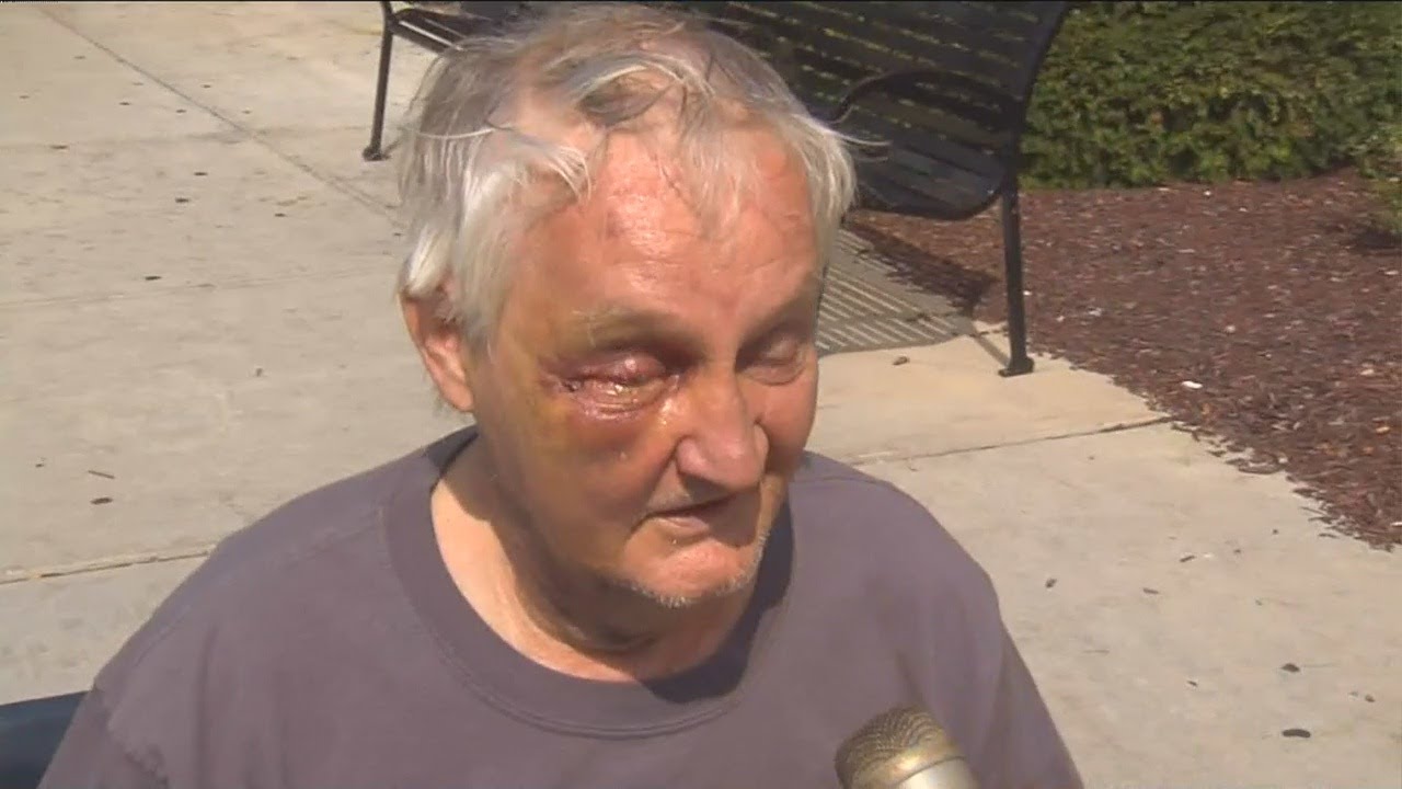 Carjacking Victim Released From Hospital; Forgives Suspects