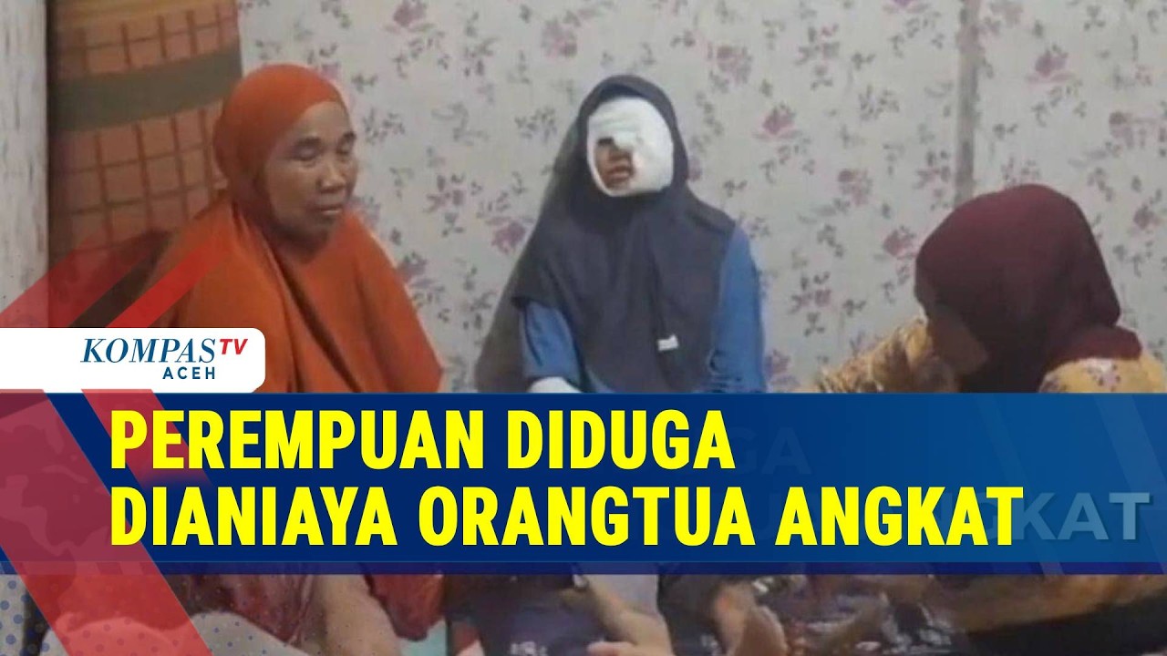 Polisi Selidiki Dugaan Penyiraman Air Panas pada Perempuan 21 Tahun oleh Orangtua Angkat