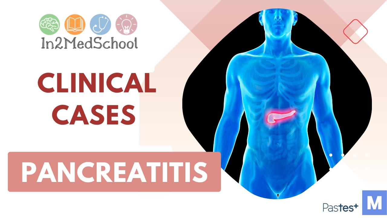 Pancreatitis Clinical Case