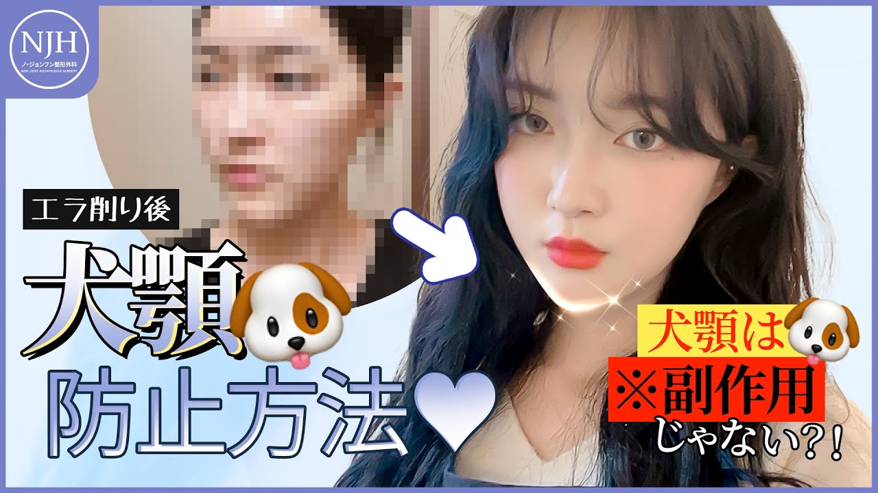 【韓国輪郭整形】エラ手術後、犬顎になってしまわないか心配です🐶☹️