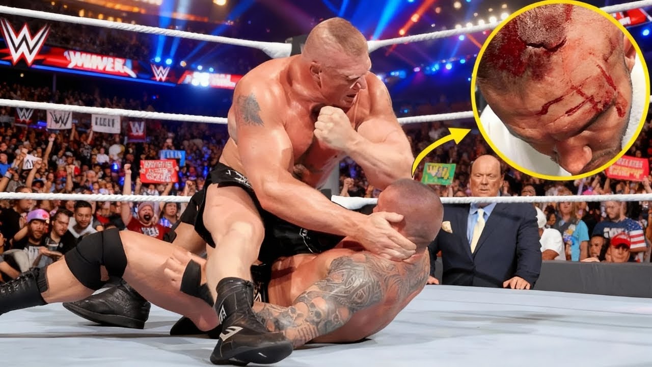 Ciarki przy Oglądaniu: 10 Najstraszniejszych Kontuzji w WWE