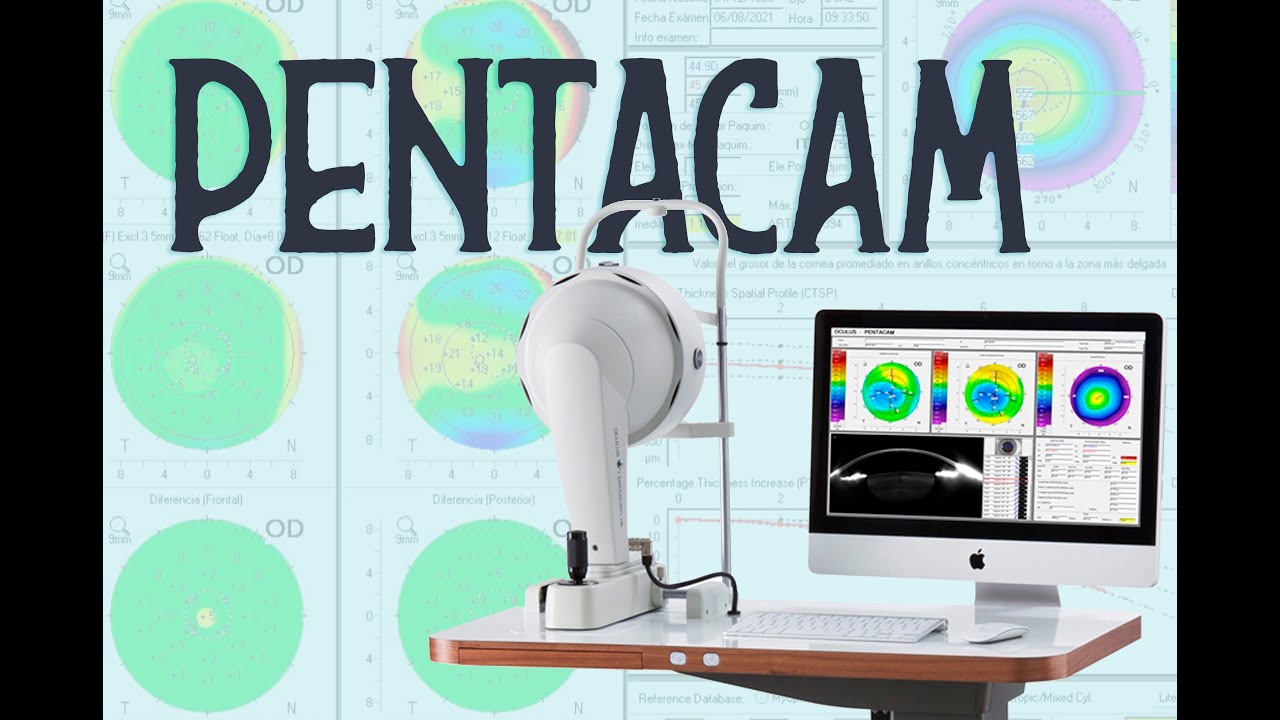 PENTACAM