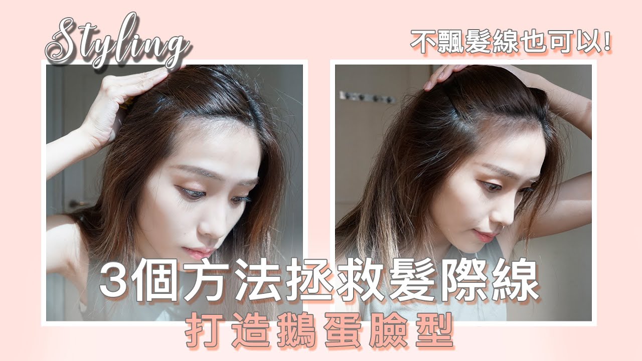 【拯救你的髮際線!】3個方法在家自救髮際線，打造鵝蛋臉型！How to cover up receding hairline?