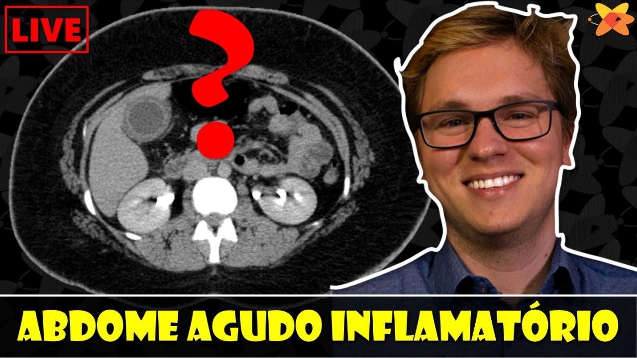 ABDOME AGUDO INFLAMATÓRIO NA TOMOGRAFIA: APRENDA COM CASOS PRÁTICOS | LIVE DE TC #10
