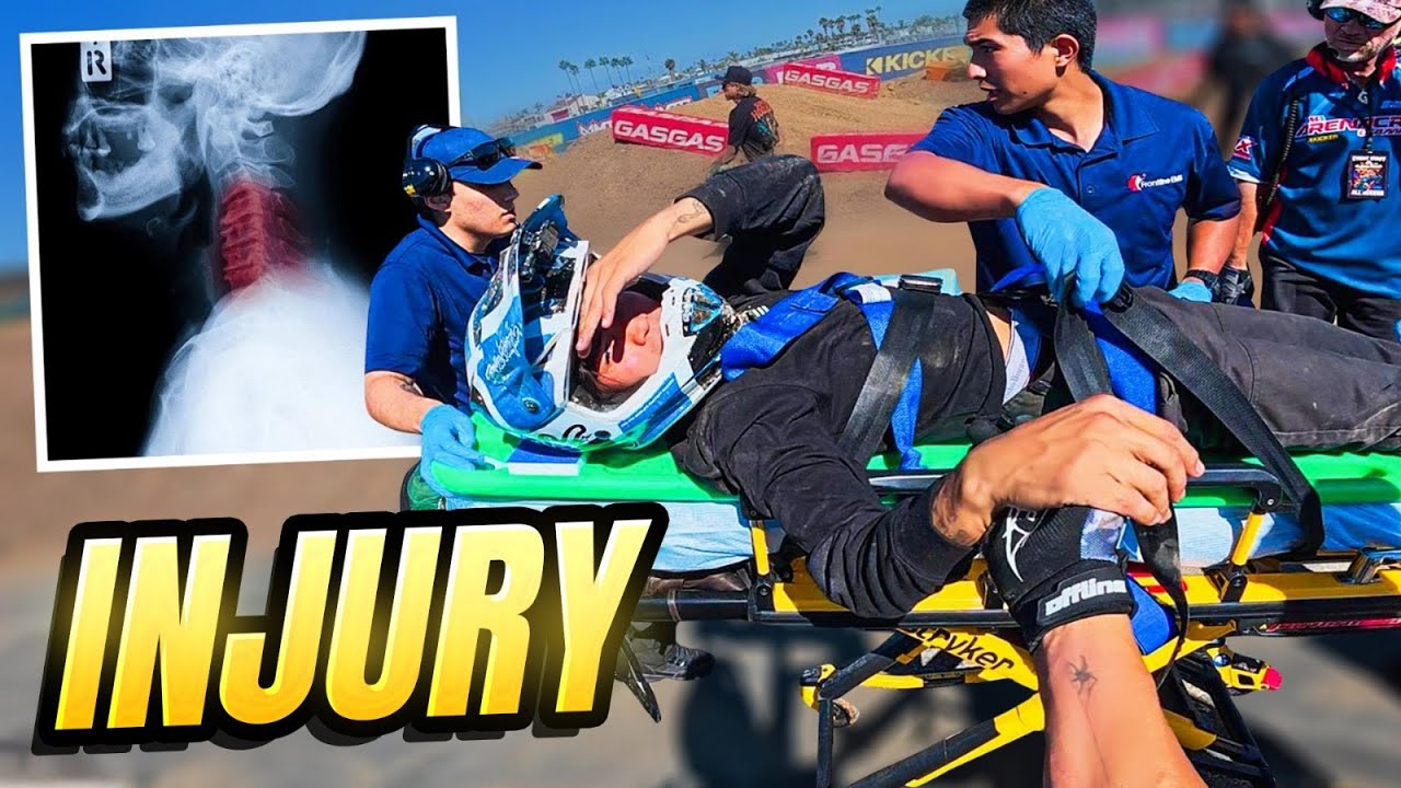 I Finally Crashed my $20,000 Surron 