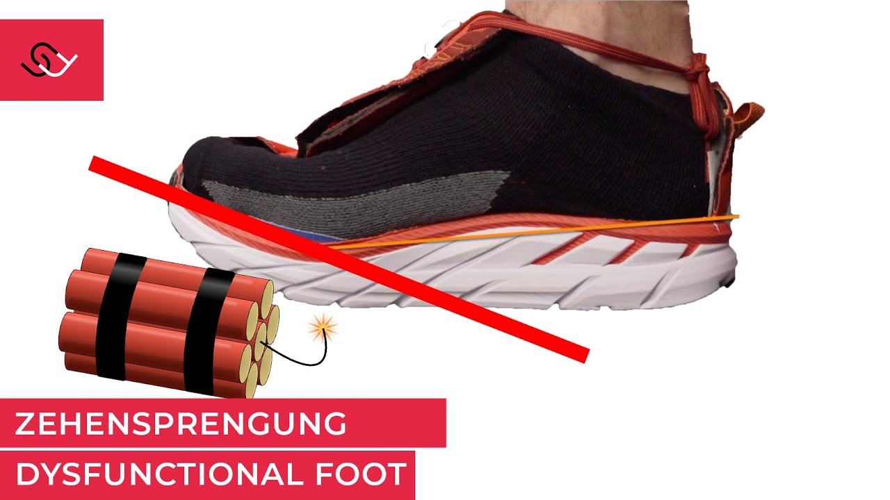 Barfußschuhe oder Functional Footwear - Zehensprengung was zur Hölle ist das?
