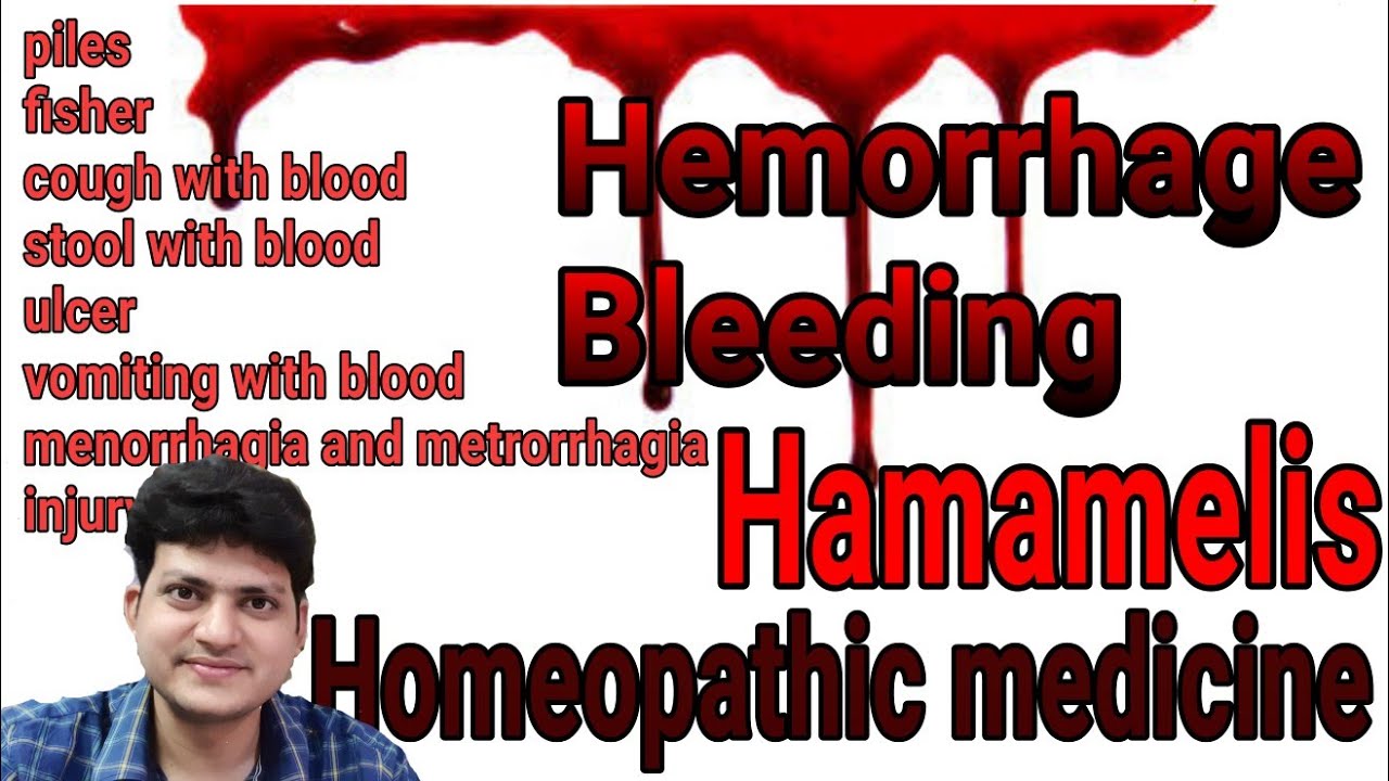 Hamamelis | Homeopathic medicine for hemorrhage ? mouth nose cough injury  piles fissure bleeding |