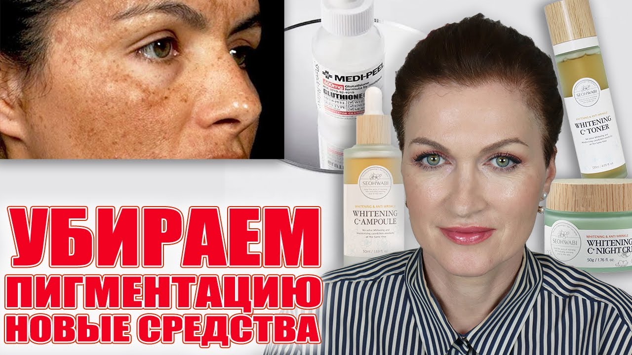 Пигментация? Решаемо!