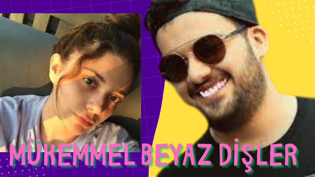Hype | Jrokez Nesrin'e Dişlerini Yaptırmaya Çalışıyor | Bembeyaz Dişler