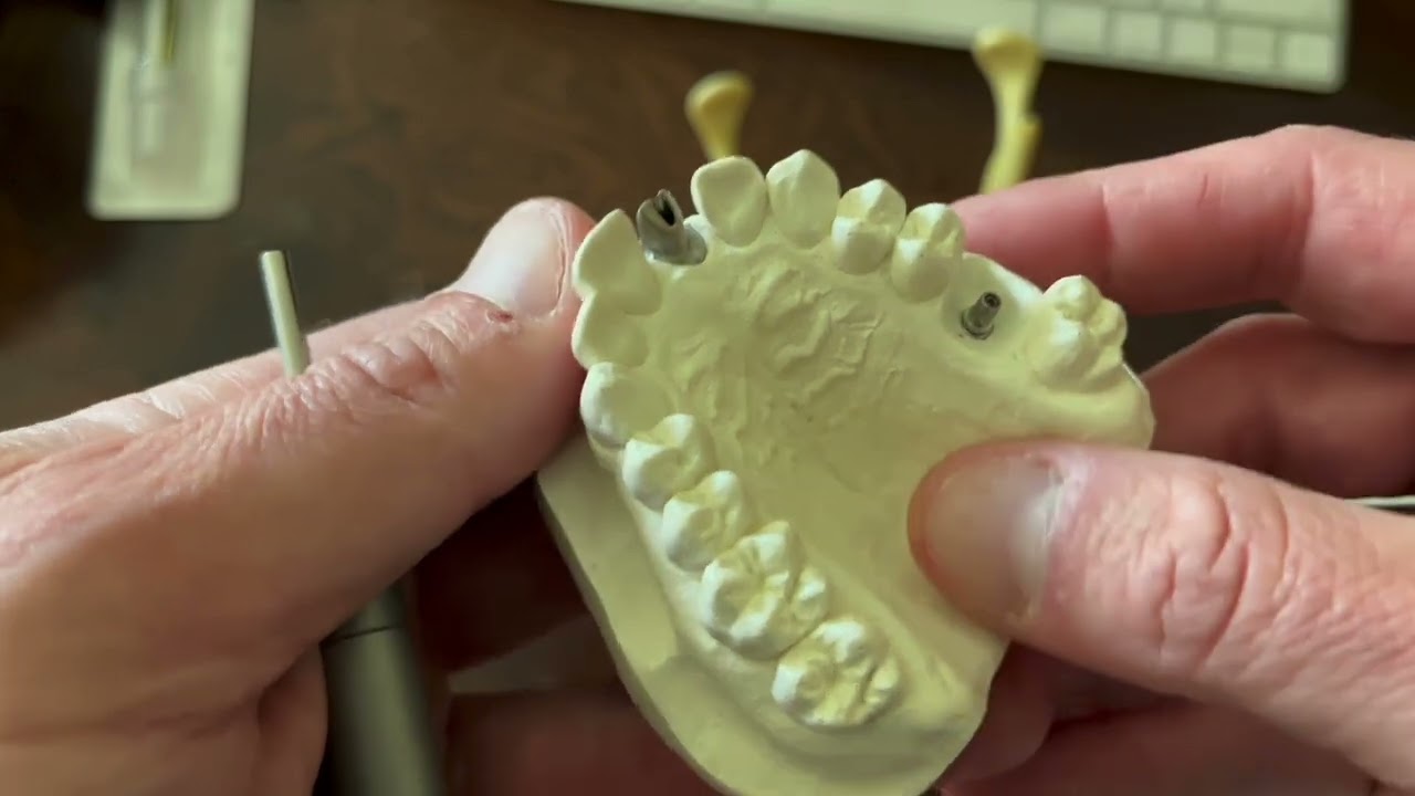 Removing Stuck Abutments from a Morse Taper Design