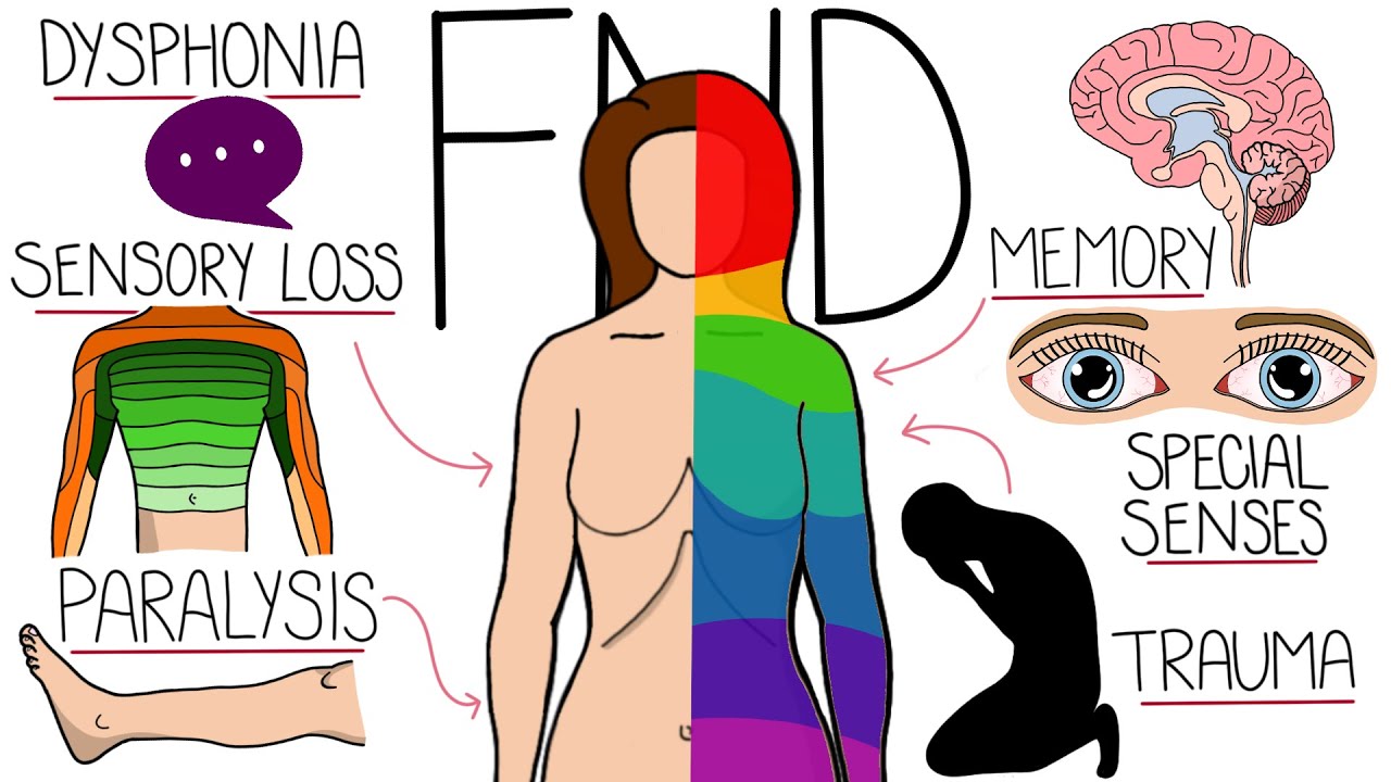 Functional Neurological Disorder (FND) Explained Clearly