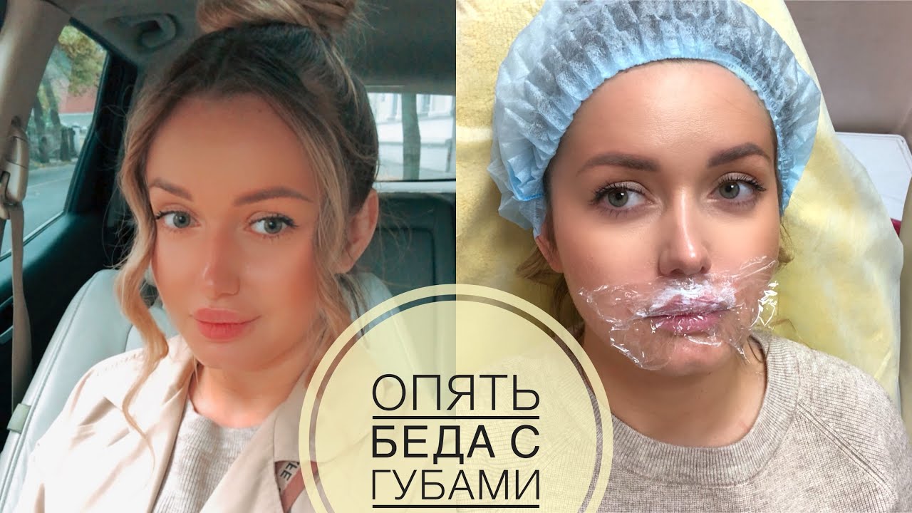 Еду сдувать губы 👄, полный кошмар