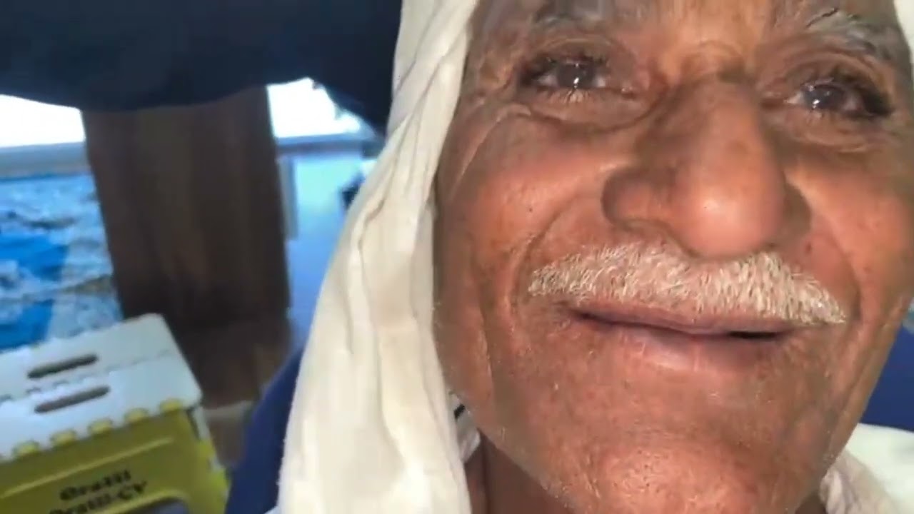  &ldquo;Upper Complete Denture | Budhape me bhi confident smile 😁&rdquo;