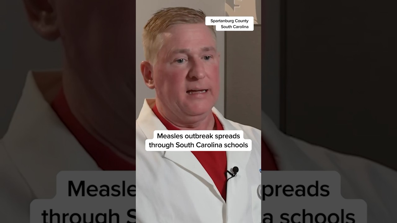 Measles outbreak spreads through South Carolina schools