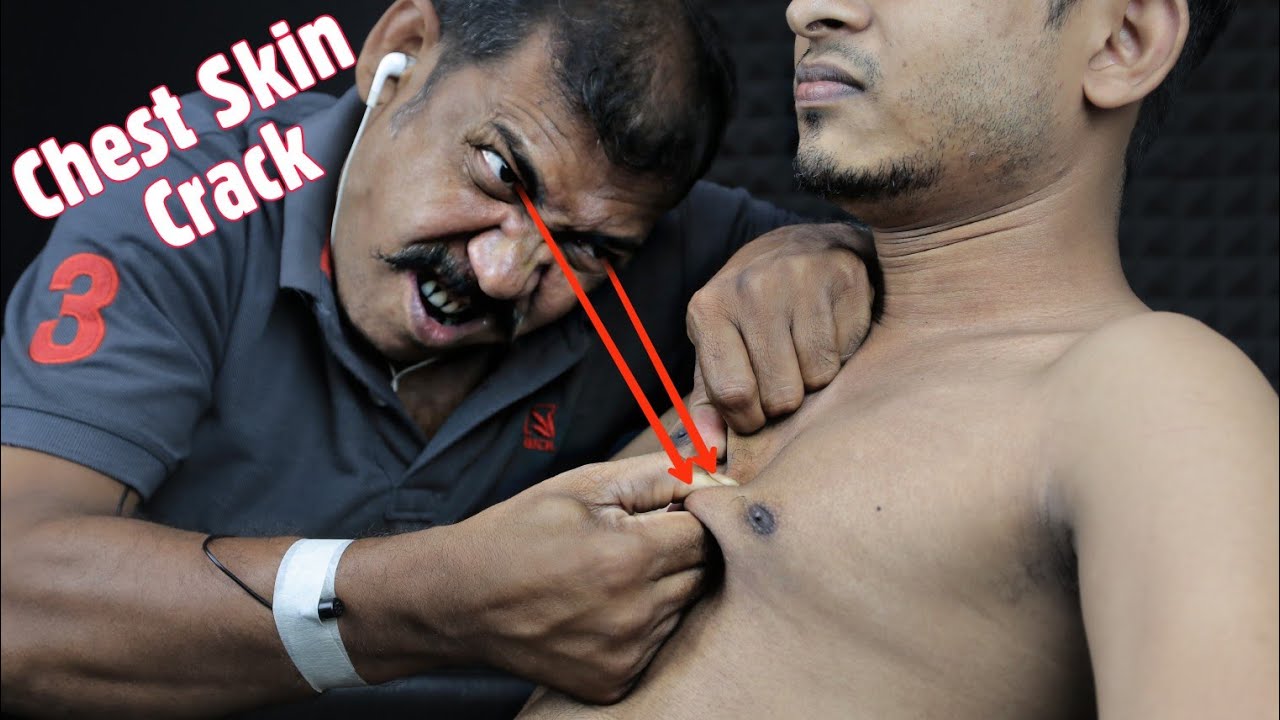 Chest Skin Crack Asmr Head And Body Massage By Asim Barber | Neck Crack And Other Body Parts Crack