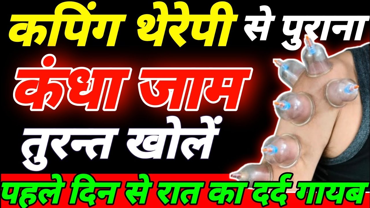 कंधा जाम हो जाए तो क्या करें Cupping Therapy|कंधा जाम की एक्सरसाइज Frozen Shoulder Hijama