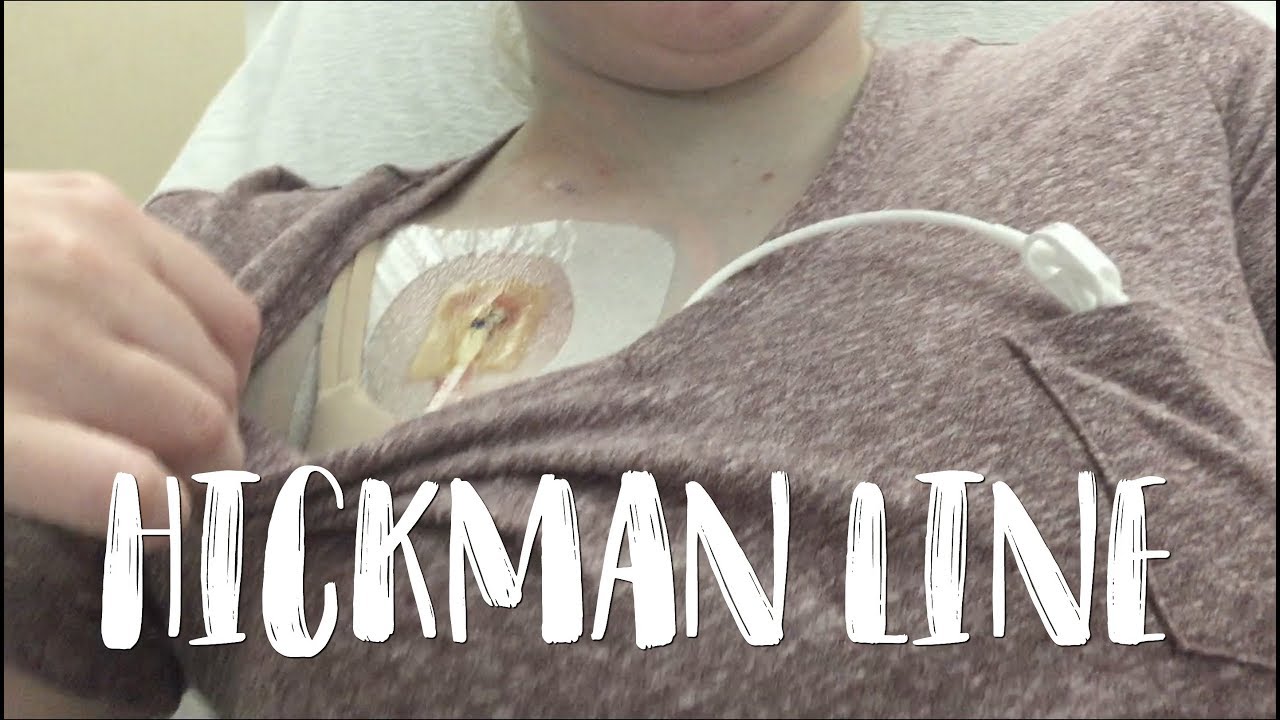 Another Hickman Line Placement | Chronic Illness Vlog