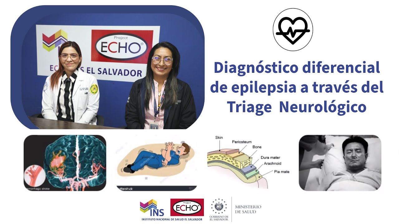 Diagnóstico diferencial de epilepsia a través del Triage Neurológico