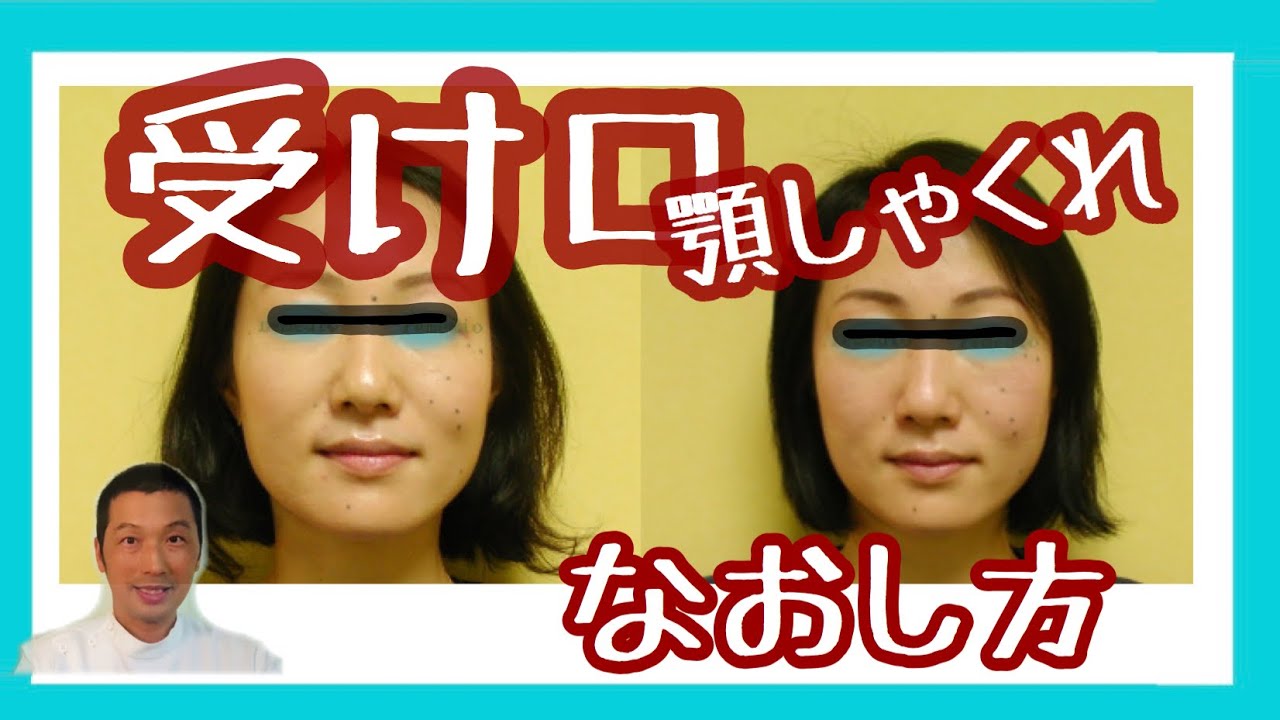 受け口 自力でなおし方