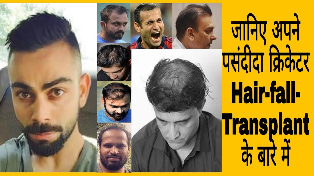 Top 10 Indian Cricket Celebrity Hair Transplant
