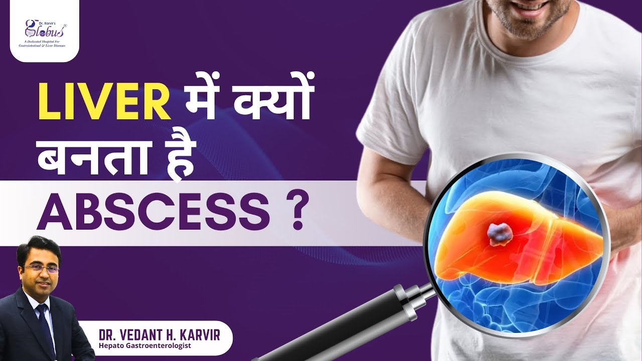 Liver Abscess: Symptoms, Diagnosis, & Treatment | Dr. Vedant Karvir - Gastroenterologist in Mumbai