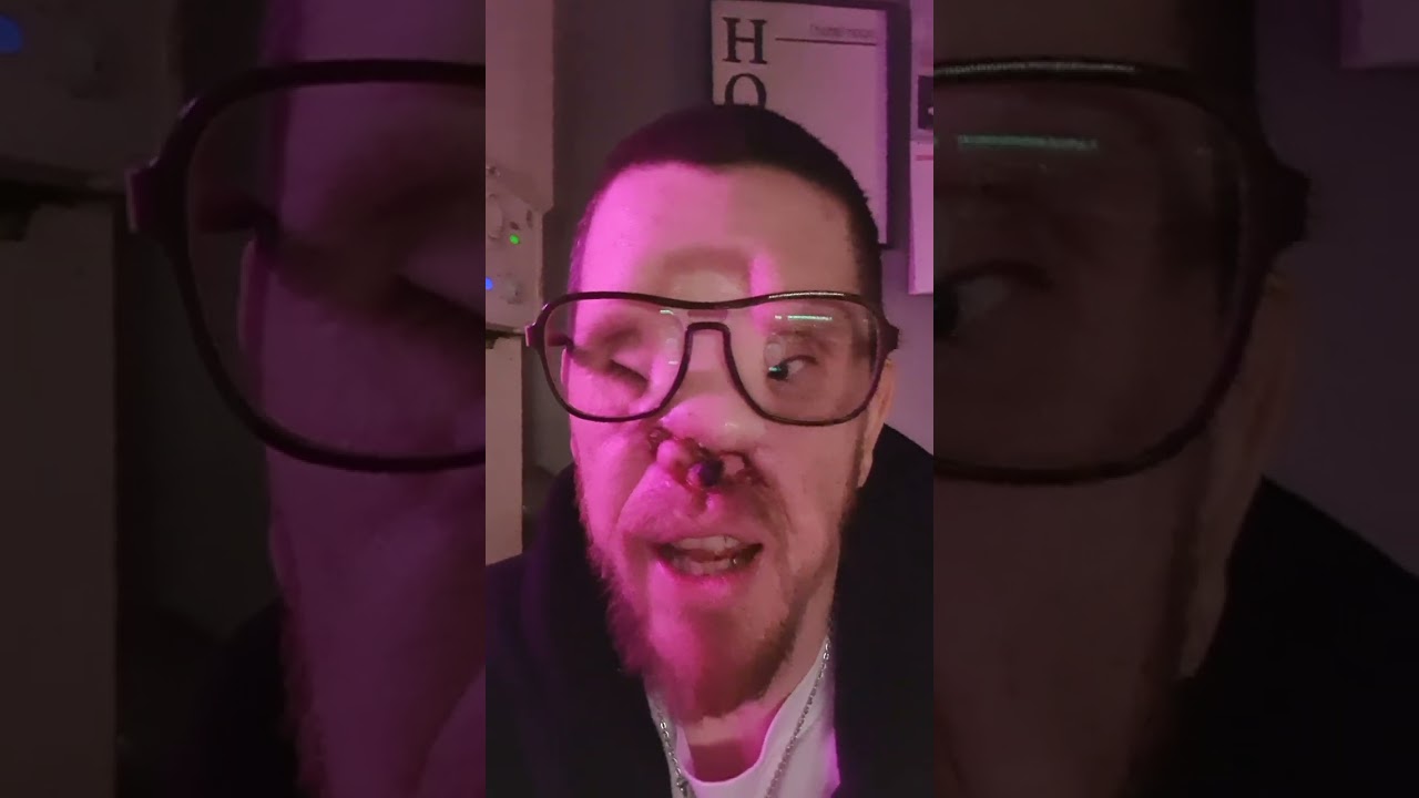 My Face Cancer update January 2024