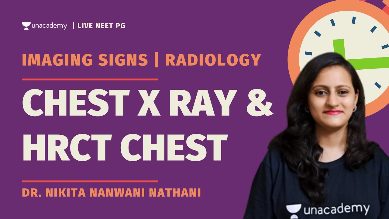Must know Imaging Signs in Chest X ray and HRCT Chest | Dr. Nikita
