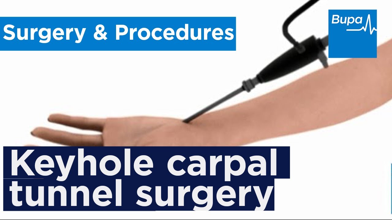 How keyhole carpal tunnel surgery is carried out | Bupa Health