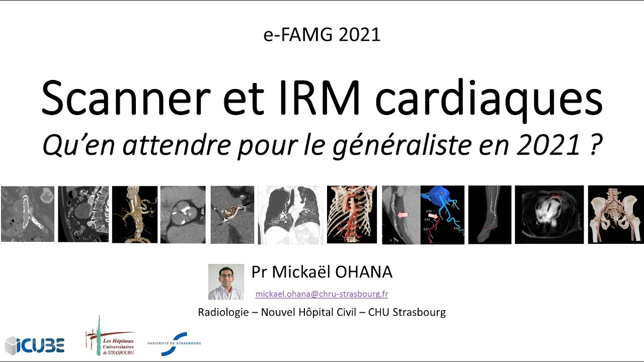 Scanner et IRM cardiaque - Qu'en attendre pour le médecin généraliste ?