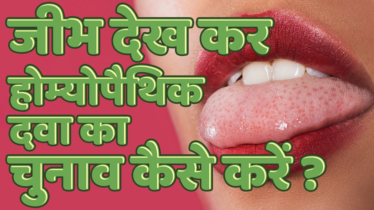 जीभ देखकर होम्योपैथिक दवा का चुनाव कैसे करें, How to choose Homeopathic Medicine based on Tongue ?