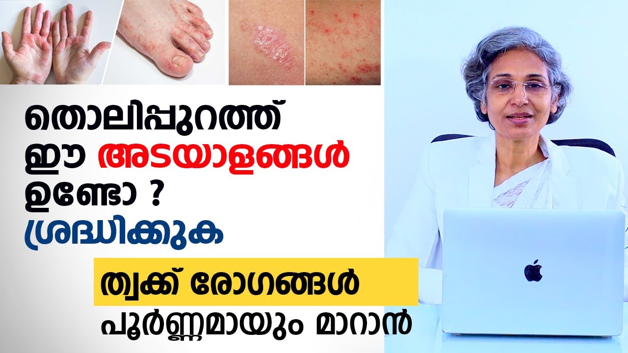 തൊലിപ്പുറത്ത് ഈ അടയാളങ്ങൾ ഉണ്ടോ ? ശ്രദ്ധിക്കുക | Psoriasis, Eczema, vitiligo Skin Diseases | Arogyam