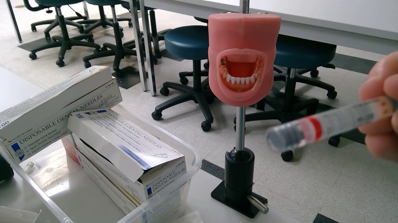 Topical Placement and Syringe Set Up