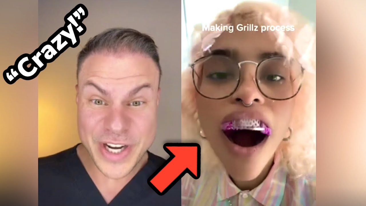 How Grillz Are Made