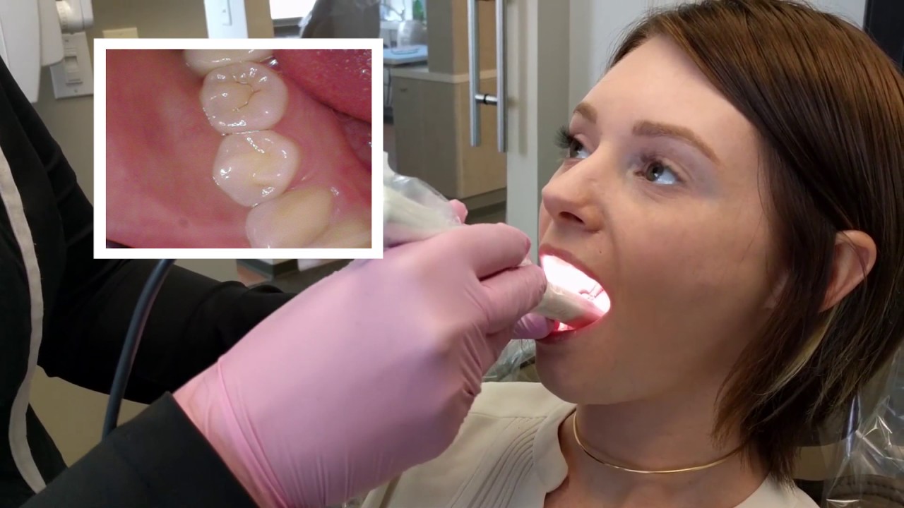 Say Cheese with Dental #HygieneWednesdays
