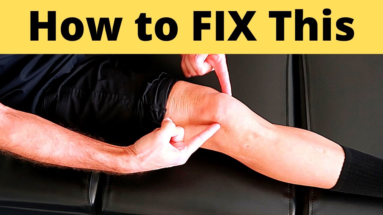 Priceless Details: How to FIX Your Knee Cap Pain💥Be the First to Try This