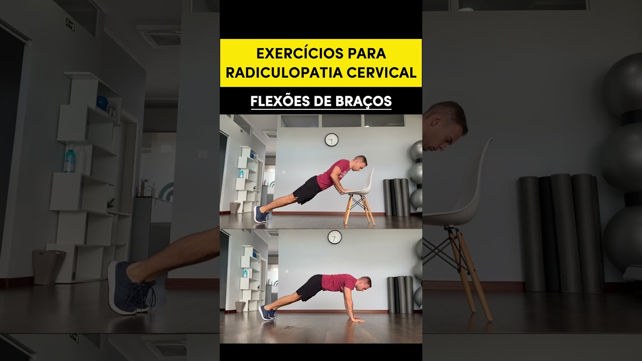 Exercícios para Radiculopatia Cervical
