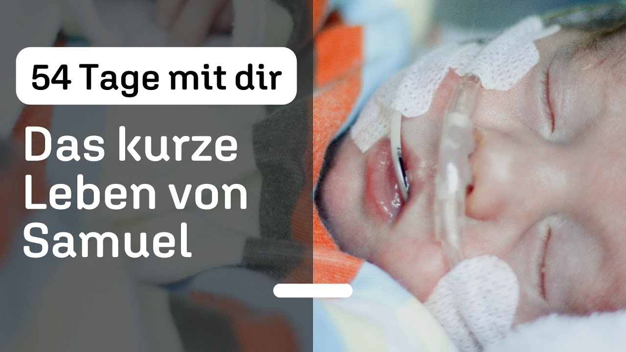 Trisomie 18: Warum das kurze Leben meines Kindes einen tiefen Sinn hatte