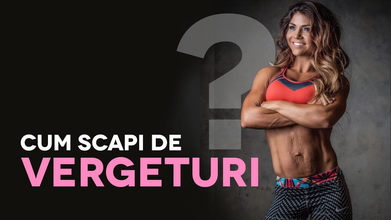Cum scapi de Vergeturi ?