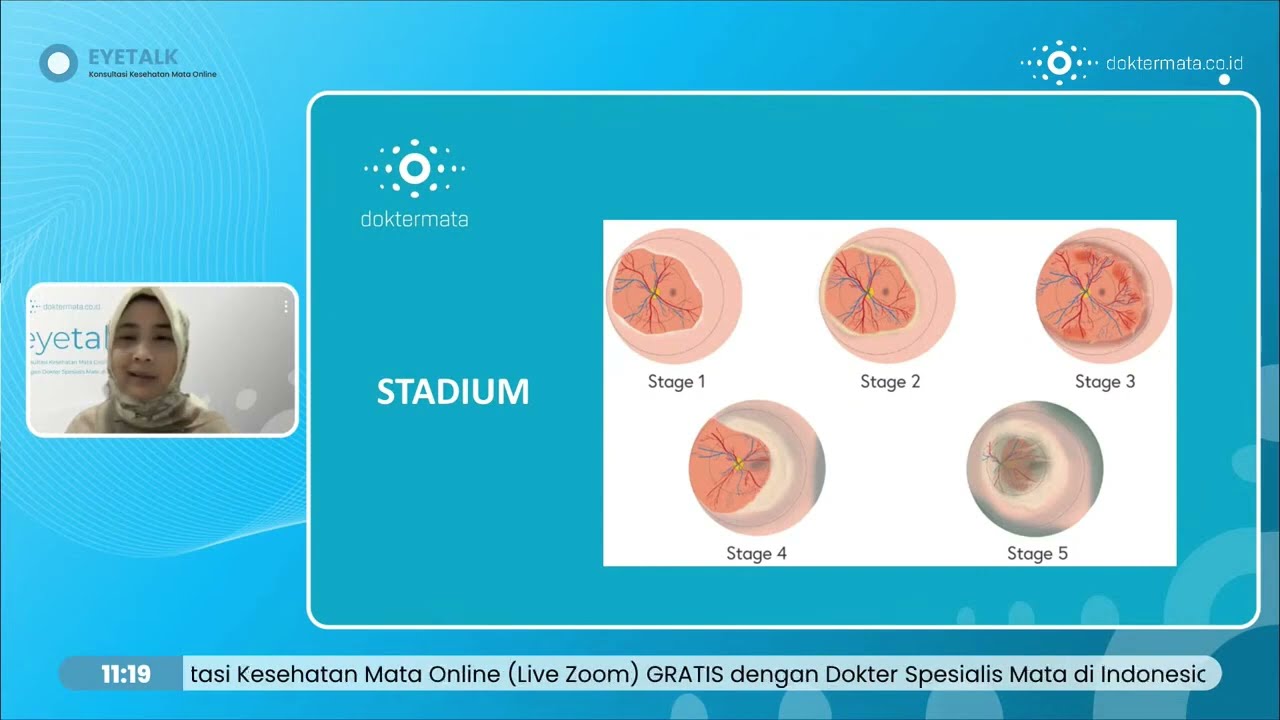 Retinopathy of Prematurity-Kelainan Mata Yang Rentan Pada Bayi Prematur dr Alissa Devi Agustina, SpM