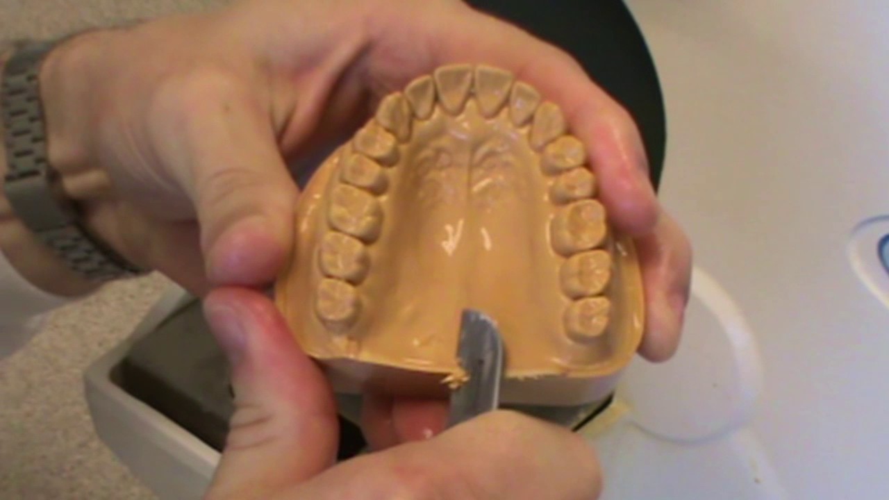 4 How to make and mount Diagnostic Casts - Trimming Diagnostic Casts