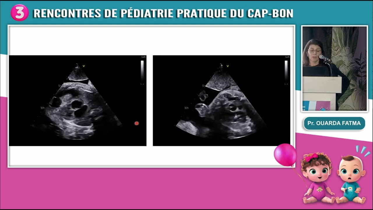 Pr  ouarda fatma